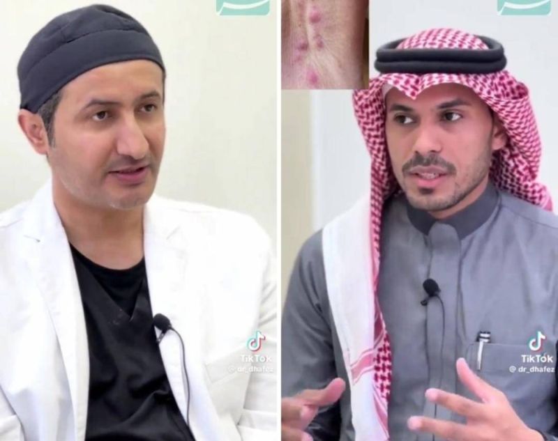 هل مزيلات العرق تسبب السرطان؟.. شاهد.. "استشاري" يجيب ويحسم الجدل