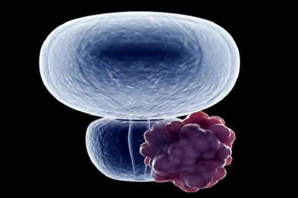 الامارات | صبغة تضيء الأنسجة السرطانية غير المرئية في البروستات