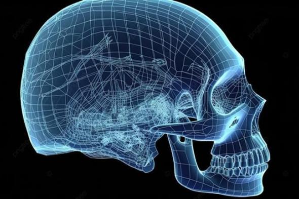 الصحة: جراحة متطورة تُعيد الشكل الطبيعي لجمجمة فتاة باستخدام تقنية الطباعة ثلاثية الأبعاد